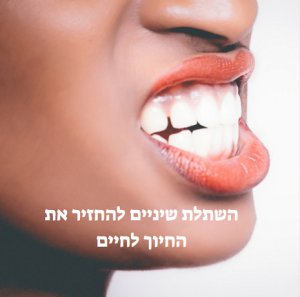 השתלת שיניים להחזיר את החיוך לחיים