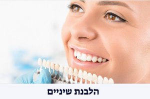 הלבנת שיניים